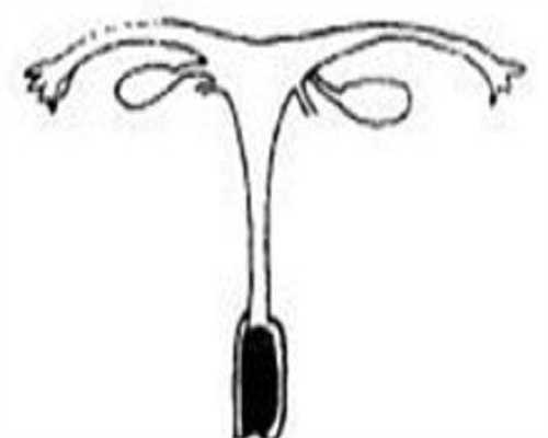 金华子宫肌瘤的食疗方法：子宫肌瘤的食疗方法有哪些