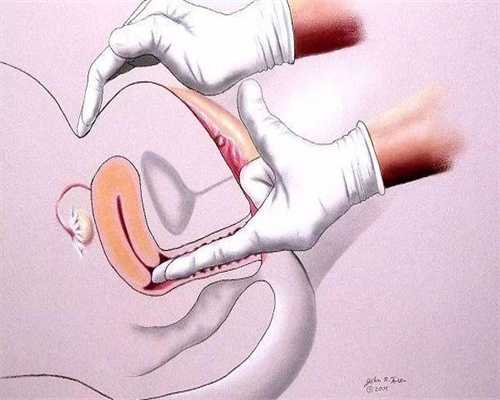 找人代生孩子：着床期胸胀是否预示着失败？着床胸胀和例假前胸胀区别