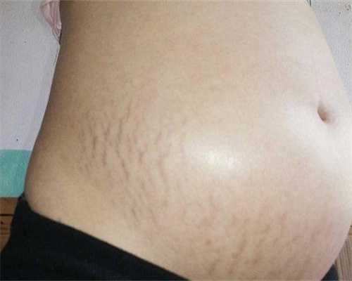 怀孕前三个月禁吃十大肉类盘点，吃羊肉必定流产真假解读