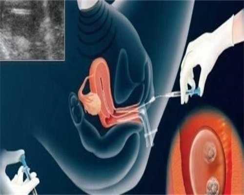 合肥助孕生宝宝费用能花多少钱